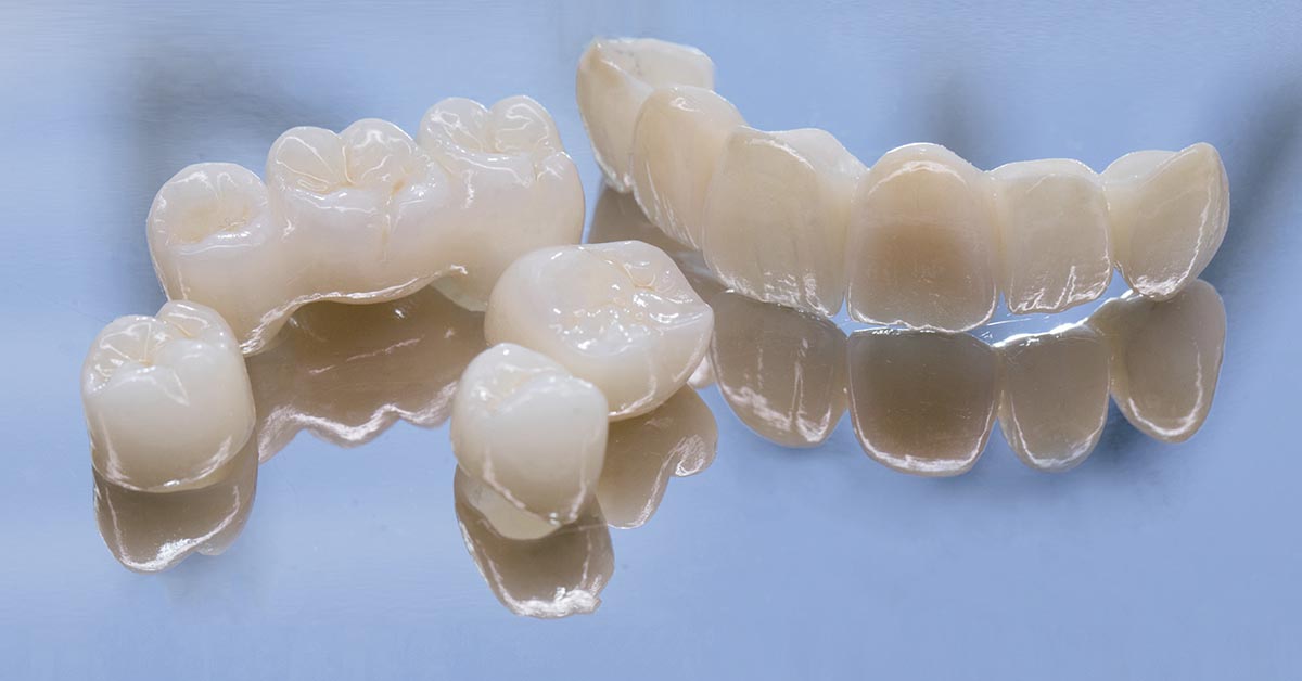 Corone dentali